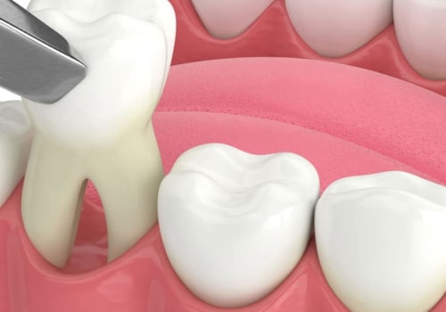 8 Tips for a Faster Recovery After Dental Surgery